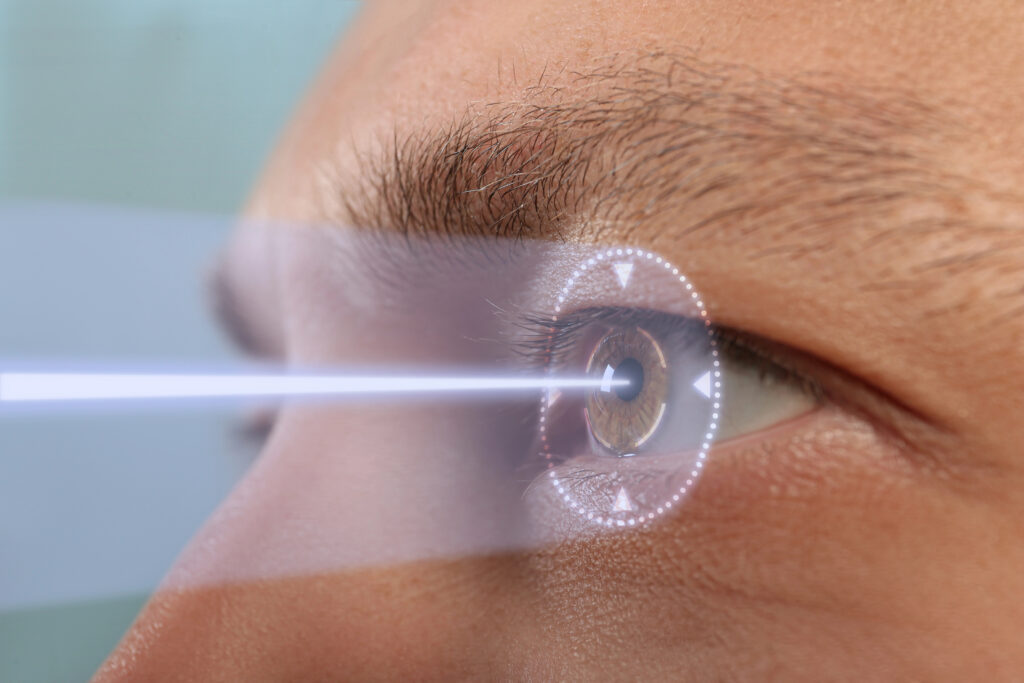 Close-up of eye during LASIK procedure with laser targeting the cornea